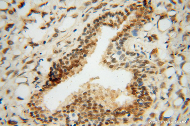 RING1 Antibody in Immunohistochemistry (Paraffin) (IHC (P))