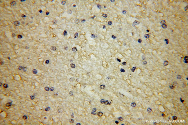 APLP2 Antibody in Immunohistochemistry (Paraffin) (IHC (P))