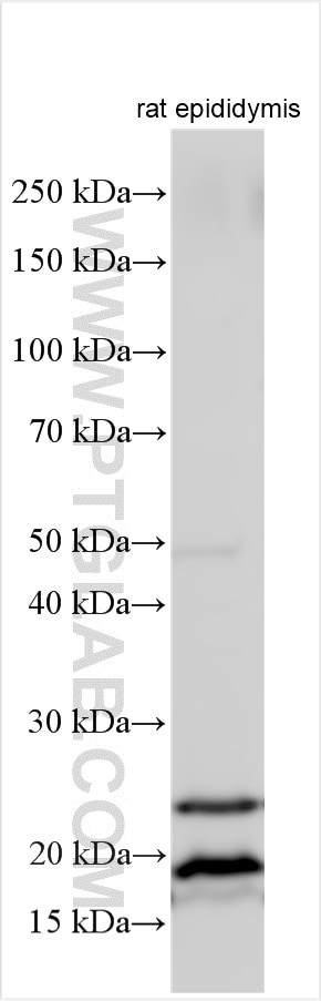 AP1S2 Antibody in Western Blot (WB)