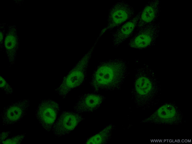 MAGEA8 Antibody in Immunocytochemistry (ICC/IF)