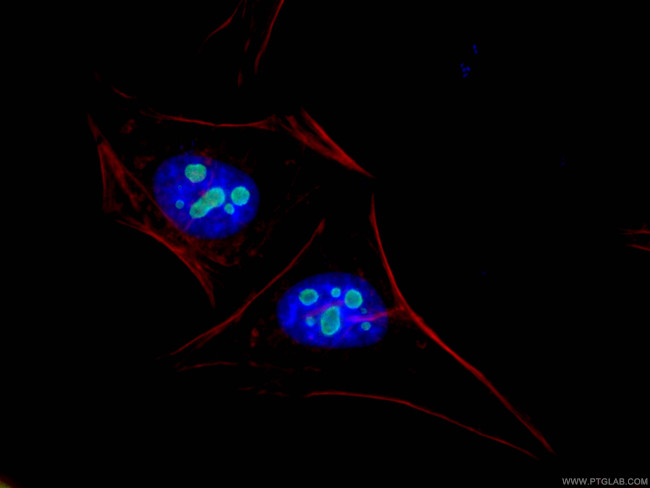 Nucleostemin Antibody in Immunocytochemistry (ICC/IF)