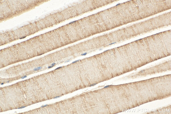 DHRS7 Antibody in Immunohistochemistry (Paraffin) (IHC (P))