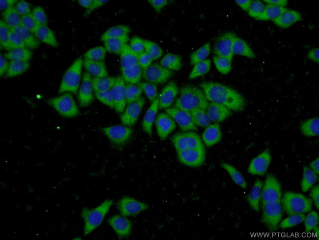 GSTT2 Antibody in Immunocytochemistry (ICC/IF)