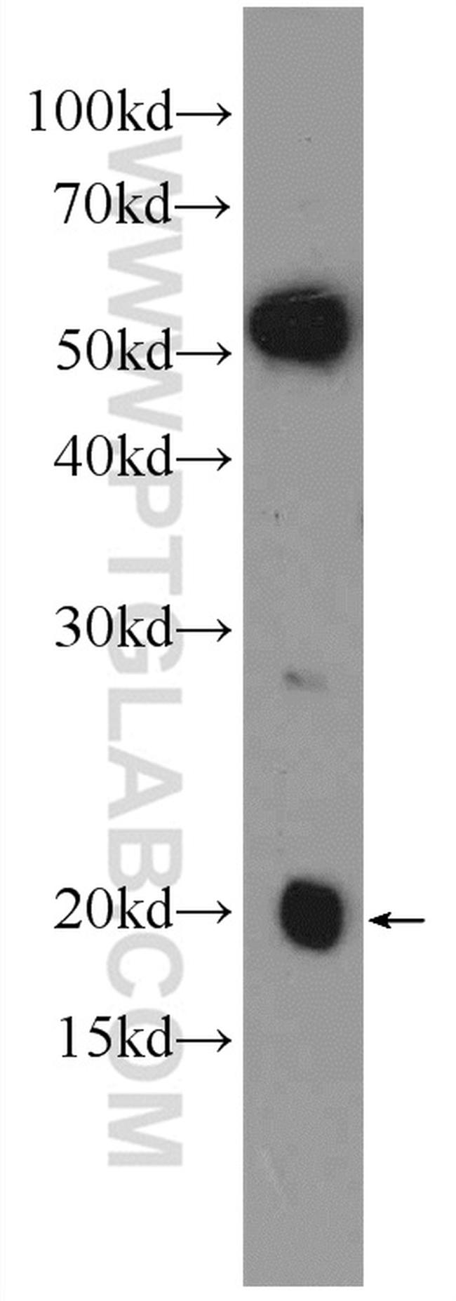 NDUFA8 Antibody in Western Blot (WB)