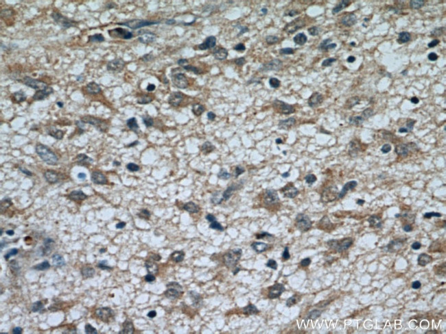 TOMM7 Antibody in Immunohistochemistry (Paraffin) (IHC (P))