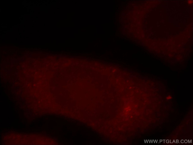 PI4K2B Antibody in Immunocytochemistry (ICC/IF)