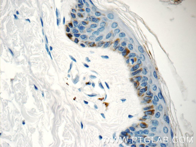 C7orf49 Antibody in Immunohistochemistry (Paraffin) (IHC (P))