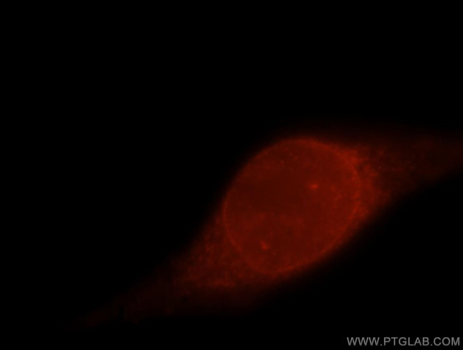 POLDIP2 Antibody in Immunocytochemistry (ICC/IF)