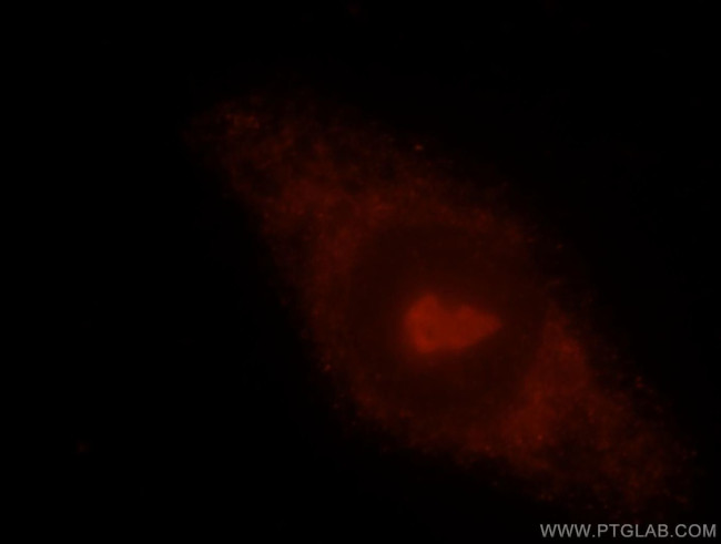 PDAP1 Antibody in Immunocytochemistry (ICC/IF)