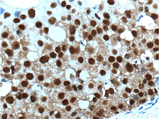 SNRPG Antibody in Immunohistochemistry (Paraffin) (IHC (P))