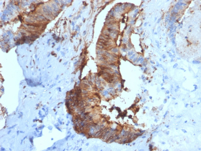 Cathepsin D Antibody in Immunohistochemistry (Paraffin) (IHC (P))