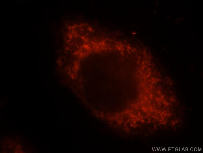 ALDH3A2 Antibody in Immunocytochemistry (ICC/IF)