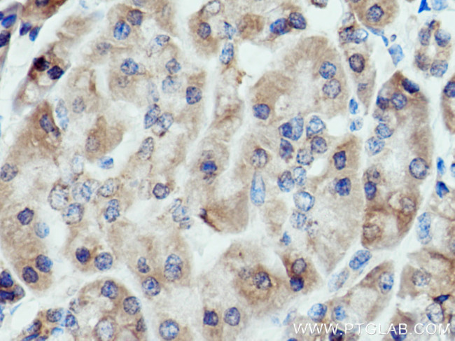 ALG2 Antibody in Immunohistochemistry (Paraffin) (IHC (P))
