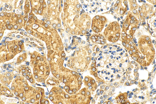 LGMN Antibody in Immunohistochemistry (Paraffin) (IHC (P))