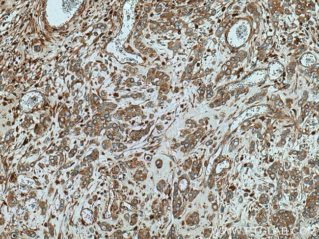 ATP6V1B2 Antibody in Immunohistochemistry (Paraffin) (IHC (P))