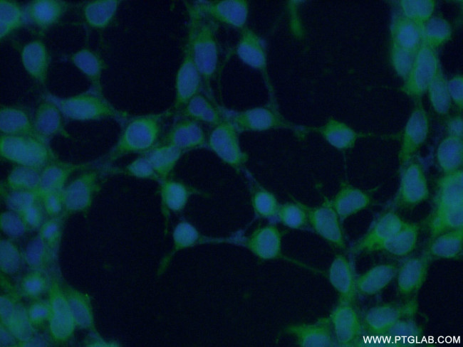 INPP5K Antibody in Immunocytochemistry (ICC/IF)