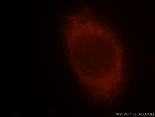 MGAT1 Antibody in Immunocytochemistry (ICC/IF)