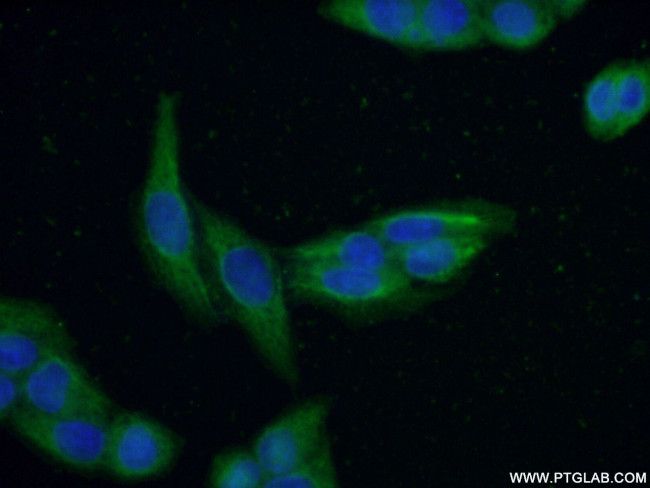 RABEPK/p40 Antibody in Immunocytochemistry (ICC/IF)