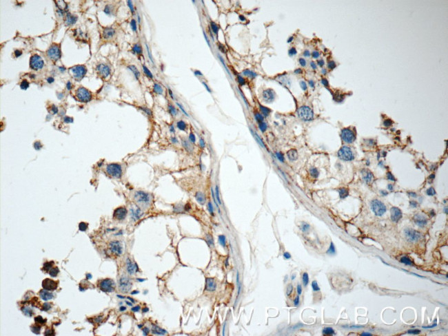 GSK3B Antibody in Immunohistochemistry (Paraffin) (IHC (P))