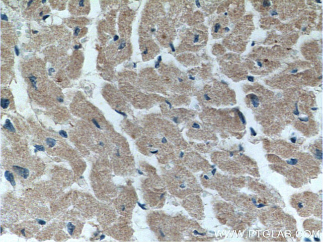 FKBP1B Antibody in Immunohistochemistry (Paraffin) (IHC (P))