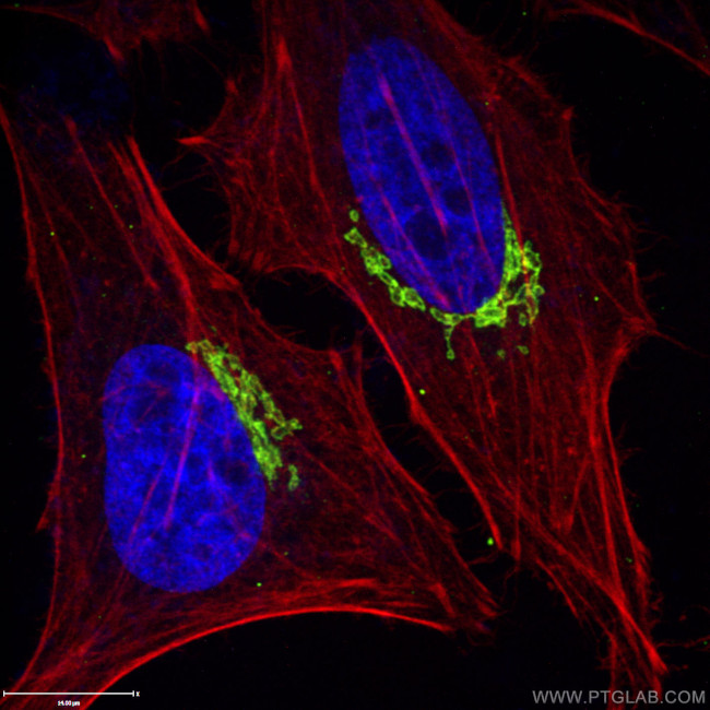 GP73/GOLPH2 Antibody in Immunocytochemistry (ICC/IF)