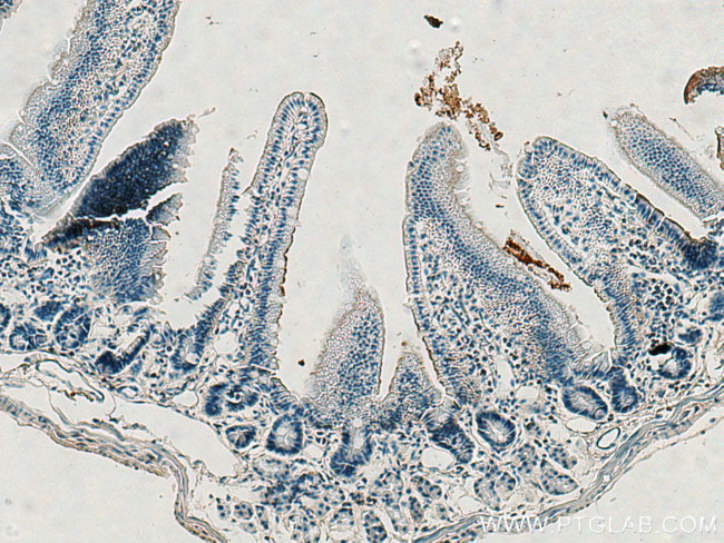 Villin Antibody in Immunohistochemistry (Paraffin) (IHC (P))