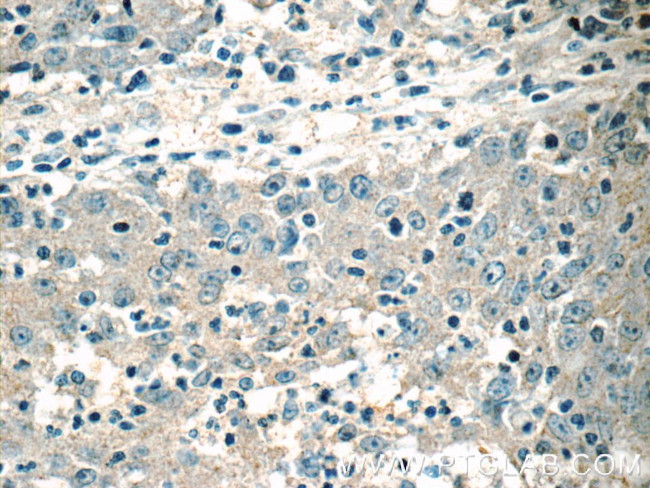 HSCB Antibody in Immunohistochemistry (Paraffin) (IHC (P))