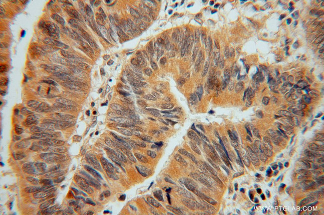 ADI1 Antibody in Immunohistochemistry (Paraffin) (IHC (P))