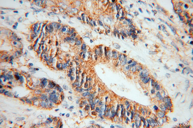 Creatine kinase B type Antibody in Immunohistochemistry (Paraffin) (IHC (P))
