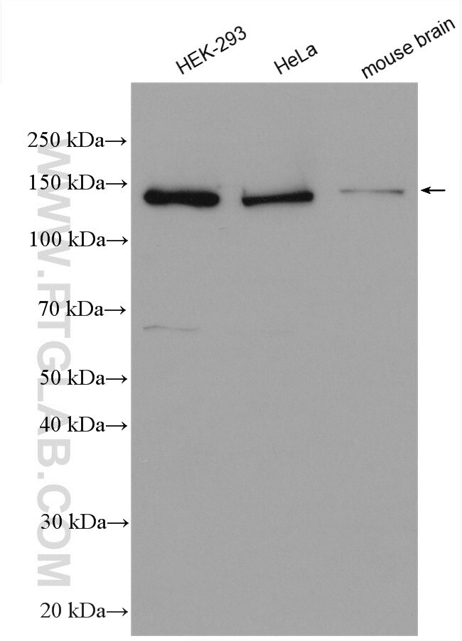 RPAP1 Antibody in Western Blot (WB)