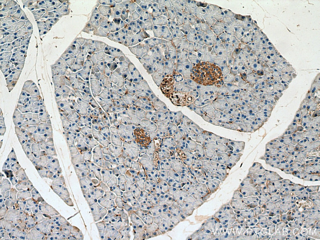 INPP5B Antibody in Immunohistochemistry (Paraffin) (IHC (P))