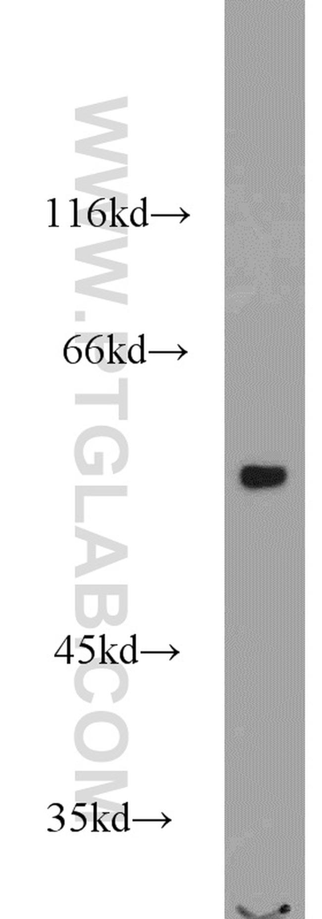 VPS72 Antibody in Western Blot (WB)