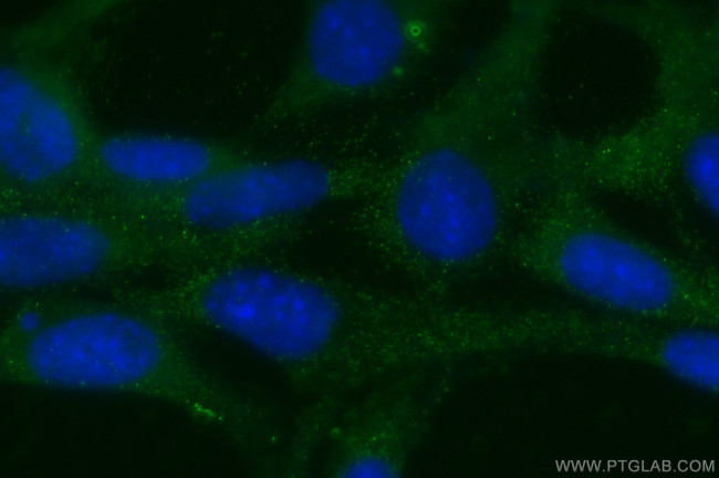 Prokineticin 1 Antibody in Immunocytochemistry (ICC/IF)