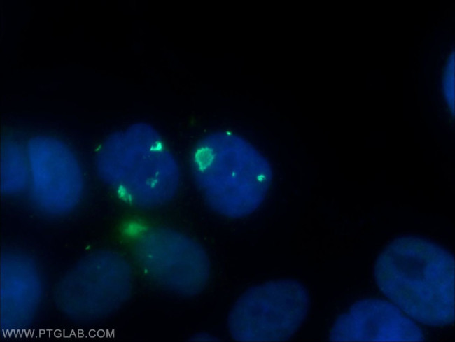 PSMB2 Antibody in Immunocytochemistry (ICC/IF)