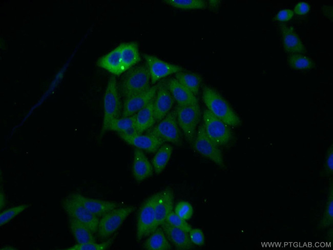 SARS Antibody in Immunocytochemistry (ICC/IF)