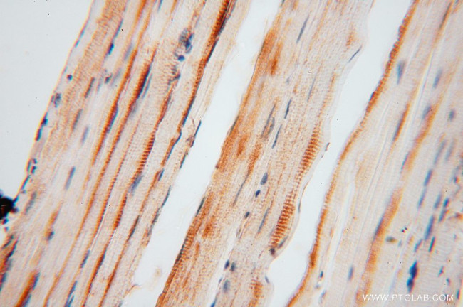 FEM1A Antibody in Immunohistochemistry (Paraffin) (IHC (P))