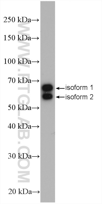 Retrolinkin Antibody in Western Blot (WB)