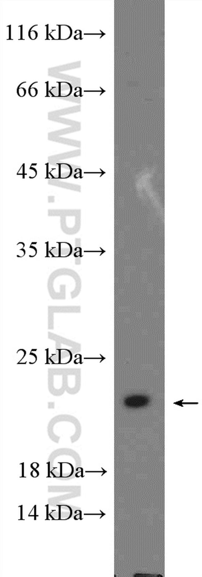 MRPL18 Antibody in Western Blot (WB)