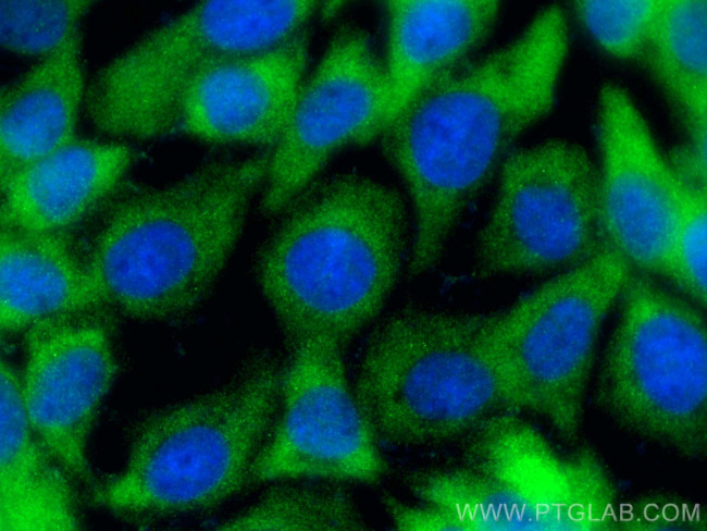 RPL34 Antibody in Immunocytochemistry (ICC/IF)