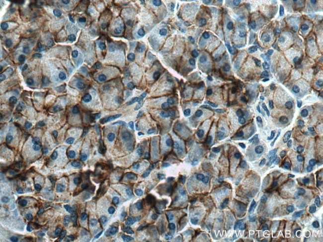 CA12 Antibody in Immunohistochemistry (Paraffin) (IHC (P))