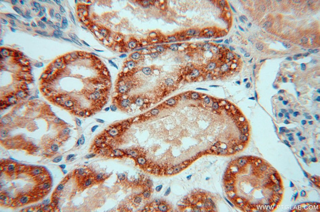 NDUFAF1 Antibody in Immunohistochemistry (Paraffin) (IHC (P))