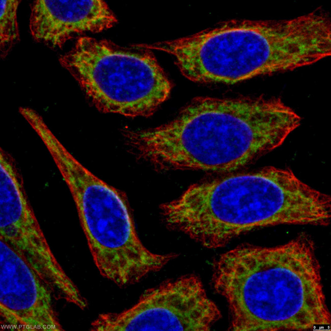 CPT1A Antibody in Immunocytochemistry (ICC/IF)