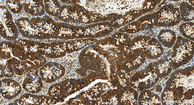 RPL36A Antibody in Immunohistochemistry (Paraffin) (IHC (P))