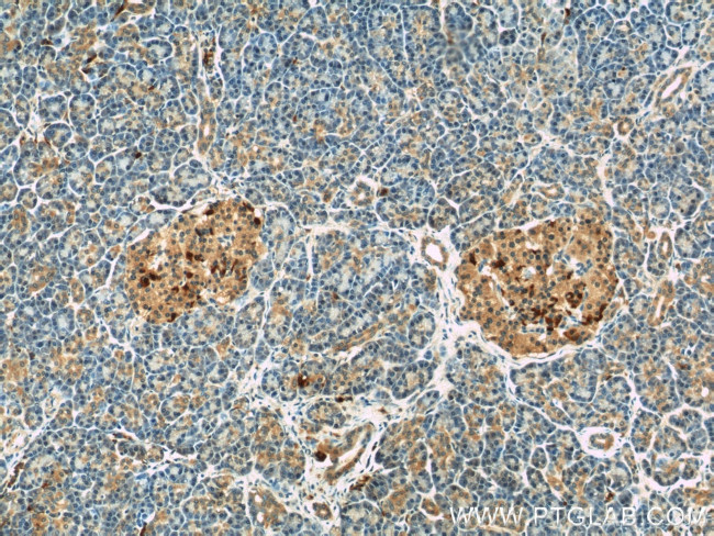 COL4A3BP Antibody in Immunohistochemistry (Paraffin) (IHC (P))