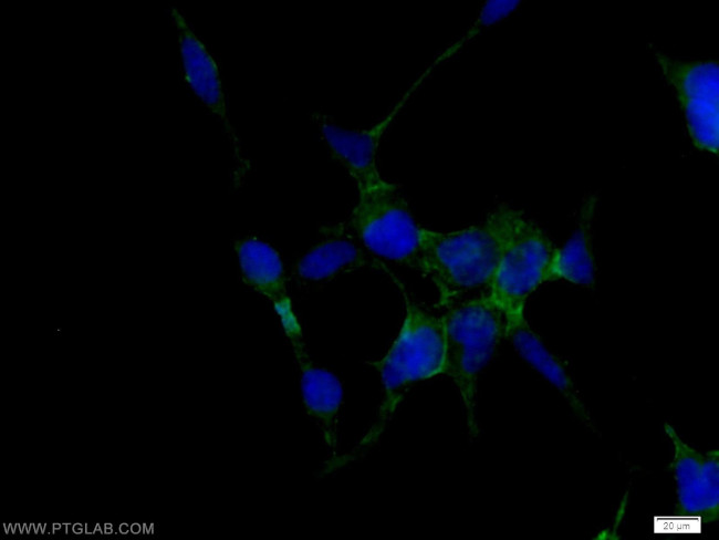 ATP1B1 Antibody in Immunocytochemistry (ICC/IF)