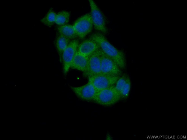 CA3 Antibody in Immunocytochemistry (ICC/IF)