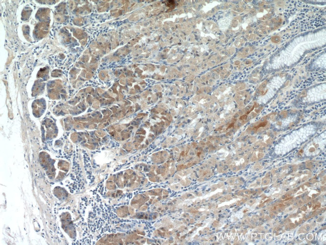 CHAC1 Antibody in Immunohistochemistry (Paraffin) (IHC (P))