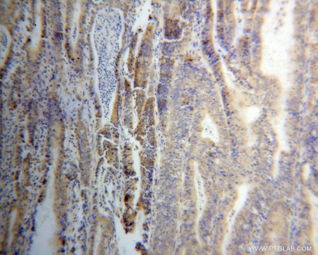 THG1L Antibody in Immunohistochemistry (Paraffin) (IHC (P))