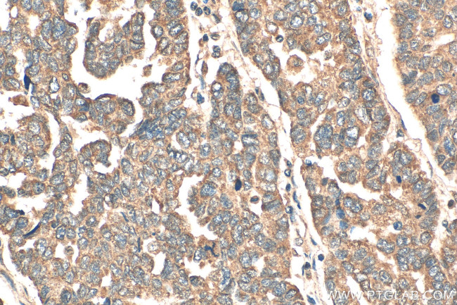 DDX19A Antibody in Immunohistochemistry (Paraffin) (IHC (P))
