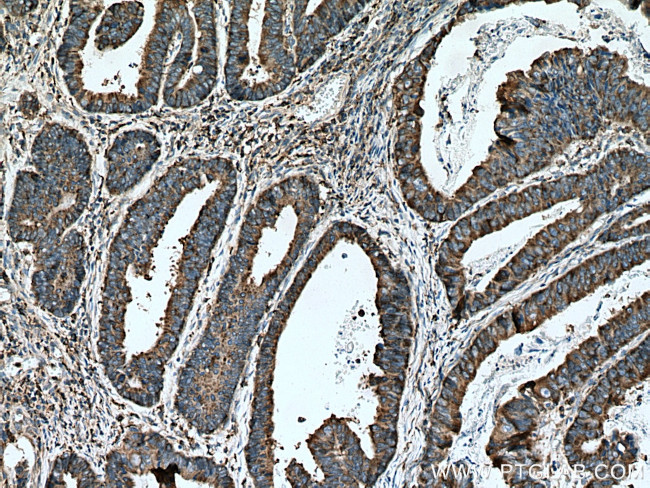 CNPY3 Antibody in Immunohistochemistry (Paraffin) (IHC (P))